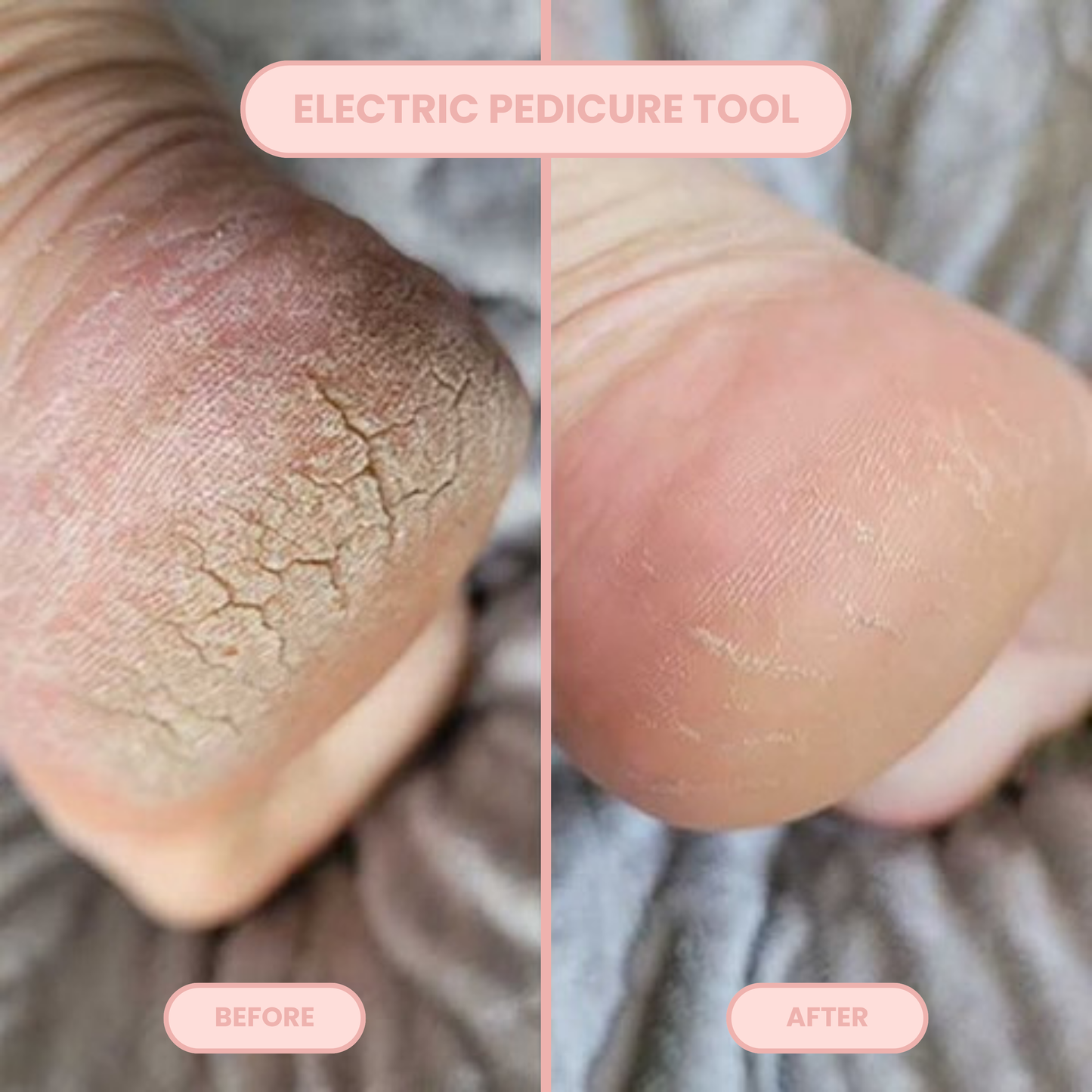 Skallus Ultimate Pedicure Kit
