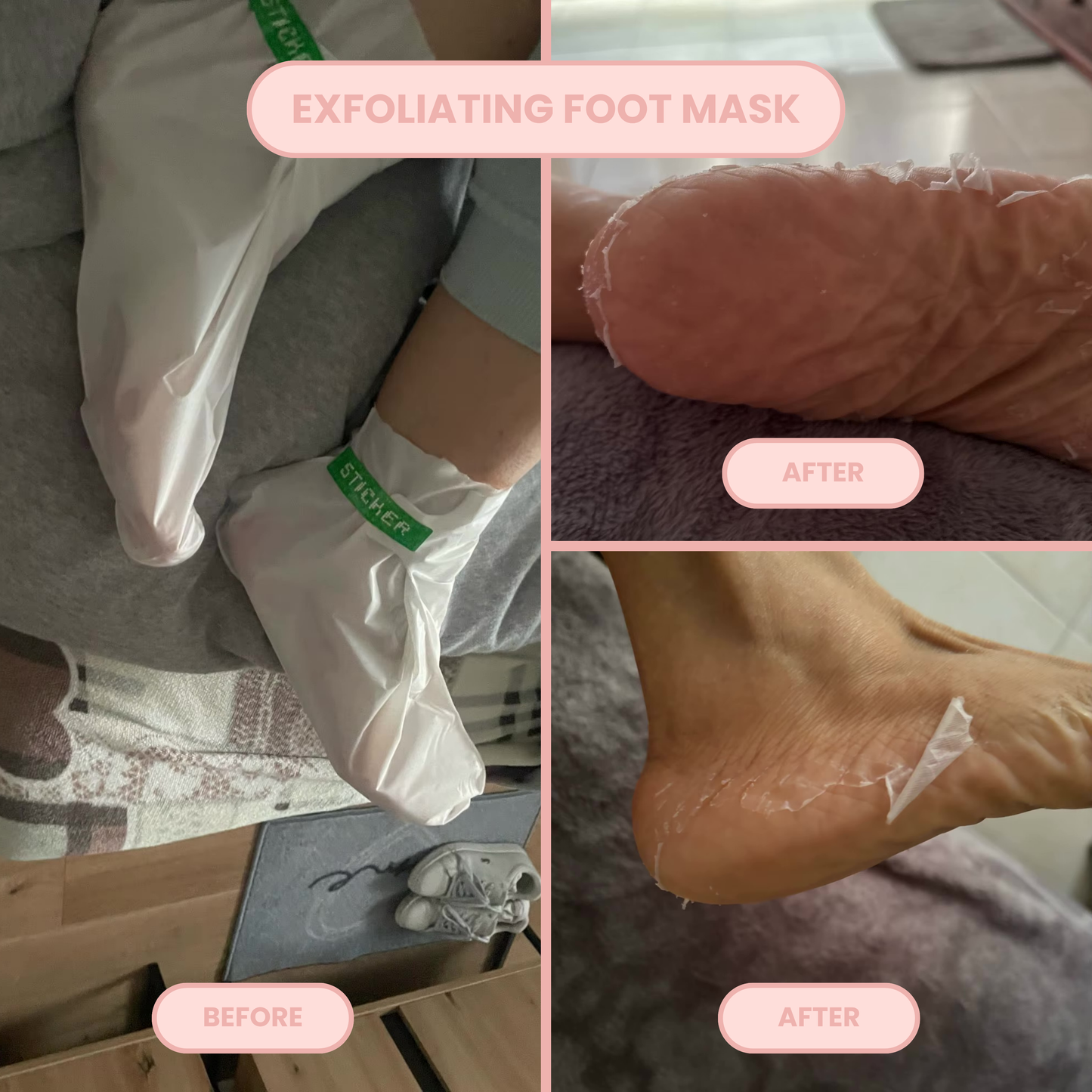 Skallus Ultimate Pedicure Kit